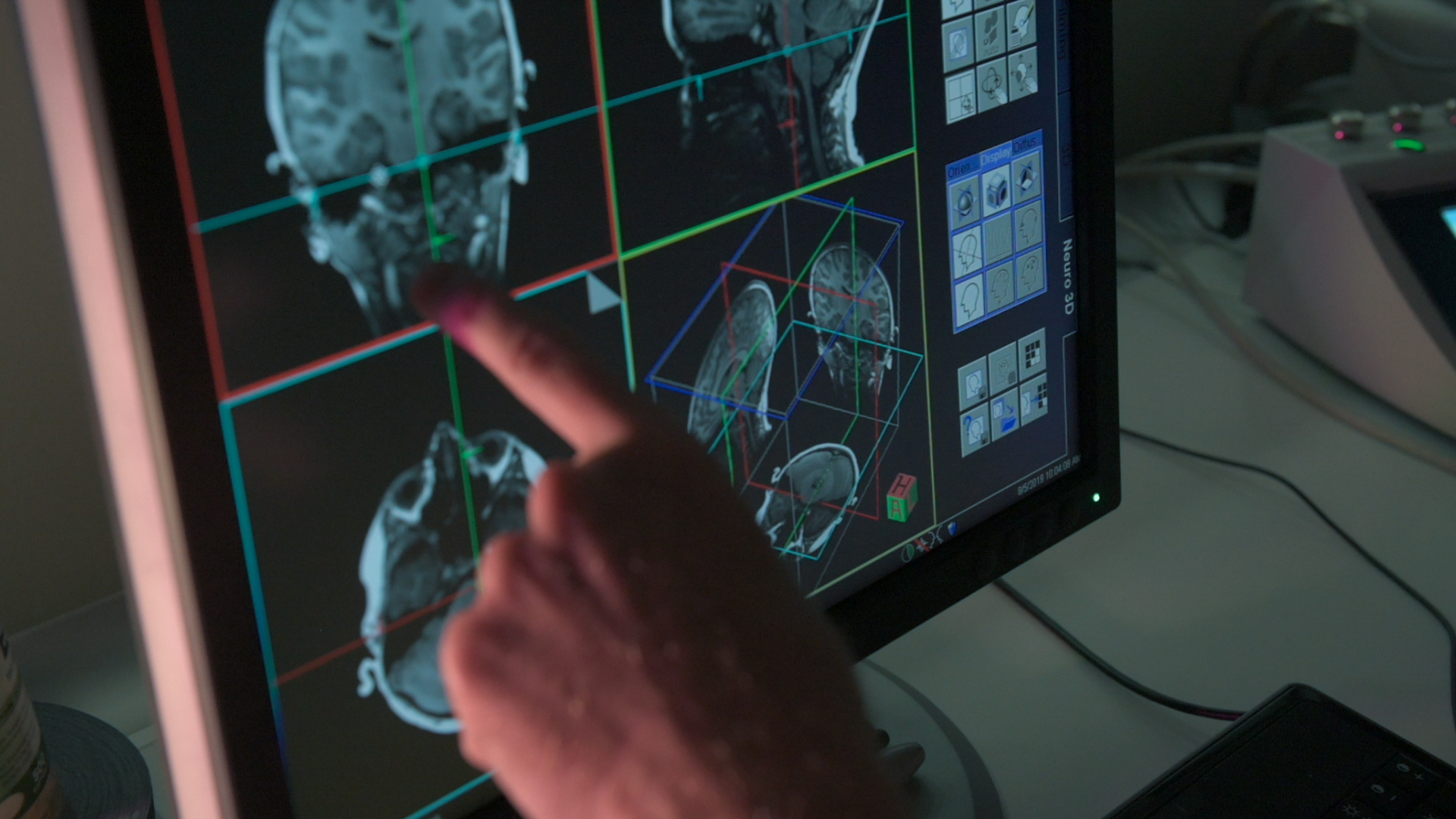 A scientist points to a brain on a computer screen